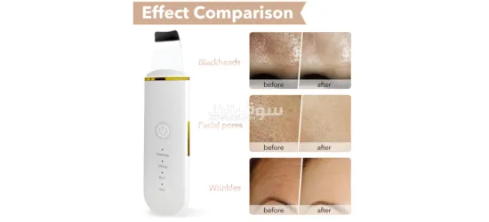 Face Skin Scrubber - 3