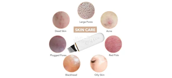 Face Skin Scrubber - 4
